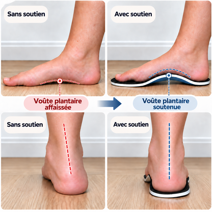Semelles Orthopédiques RelivaPlus™